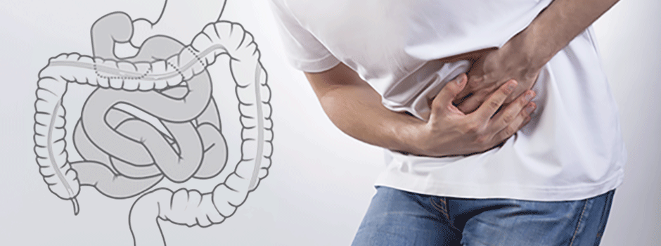 Man holding his stomach in discomfort beside a drawing of the intestines, from SANUSq Health on leaky gut syndrome