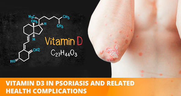 Vitamin d supplements in psoriasis